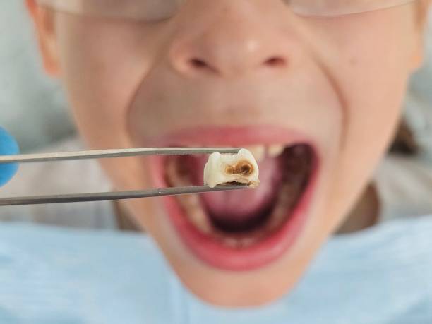 Best Walk-In Emergency Dentist in Harrah, OK